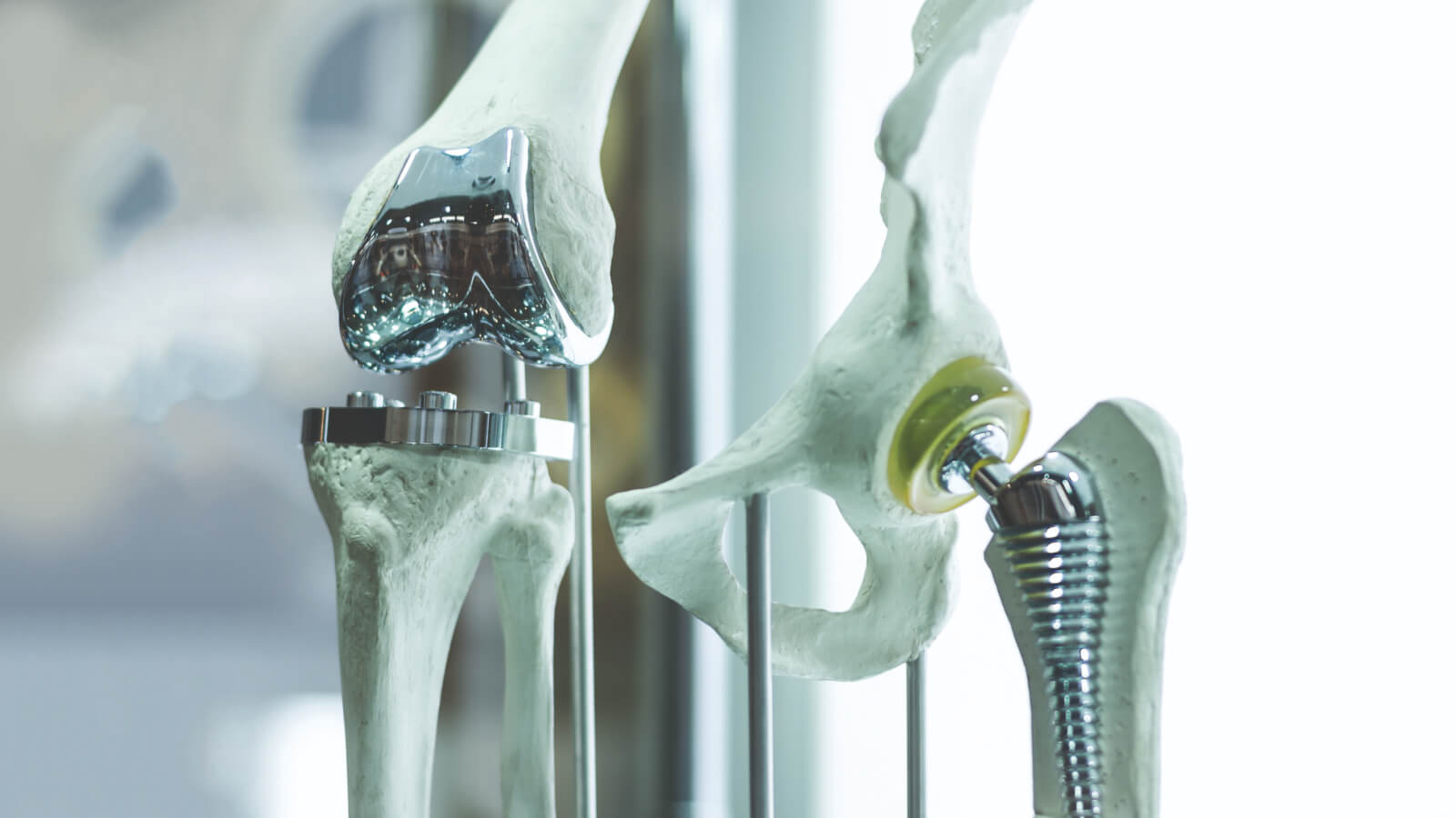 Artificial joints made of titanium